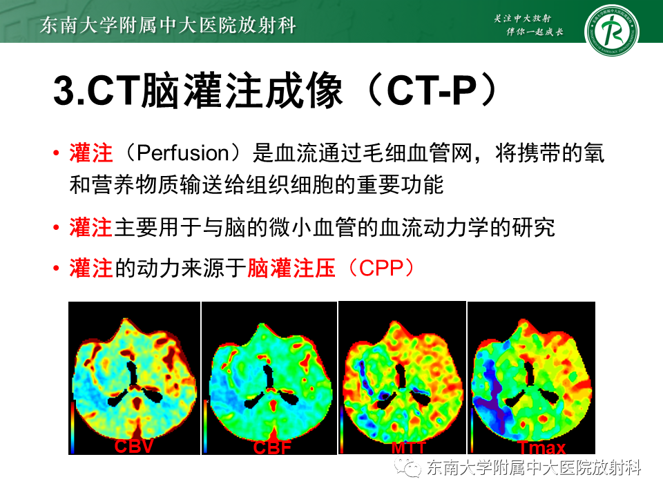 【PPT】急性缺血性脑卒中的多模态CT评估-35