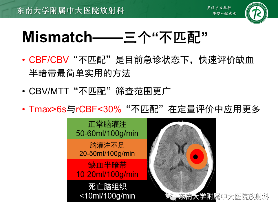 【PPT】急性缺血性脑卒中的多模态CT评估-39