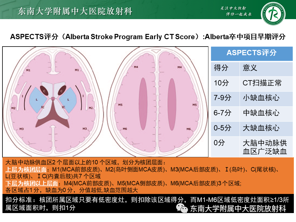 【PPT】急性缺血性脑卒中的多模态CT评估-28