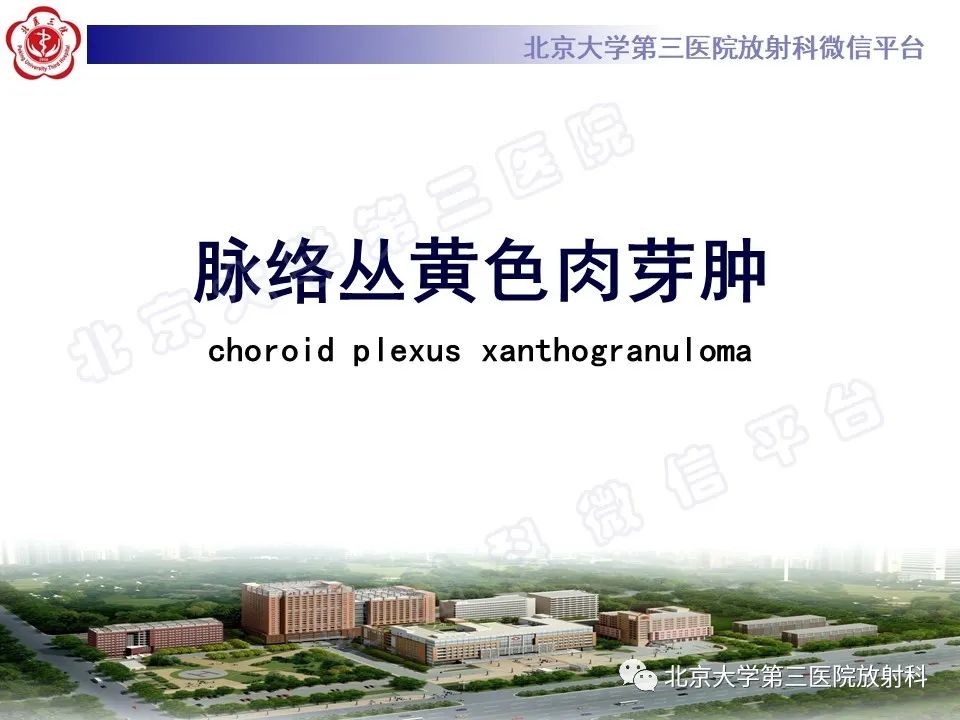 【PPT】脉络丛黄色肉芽肿-5