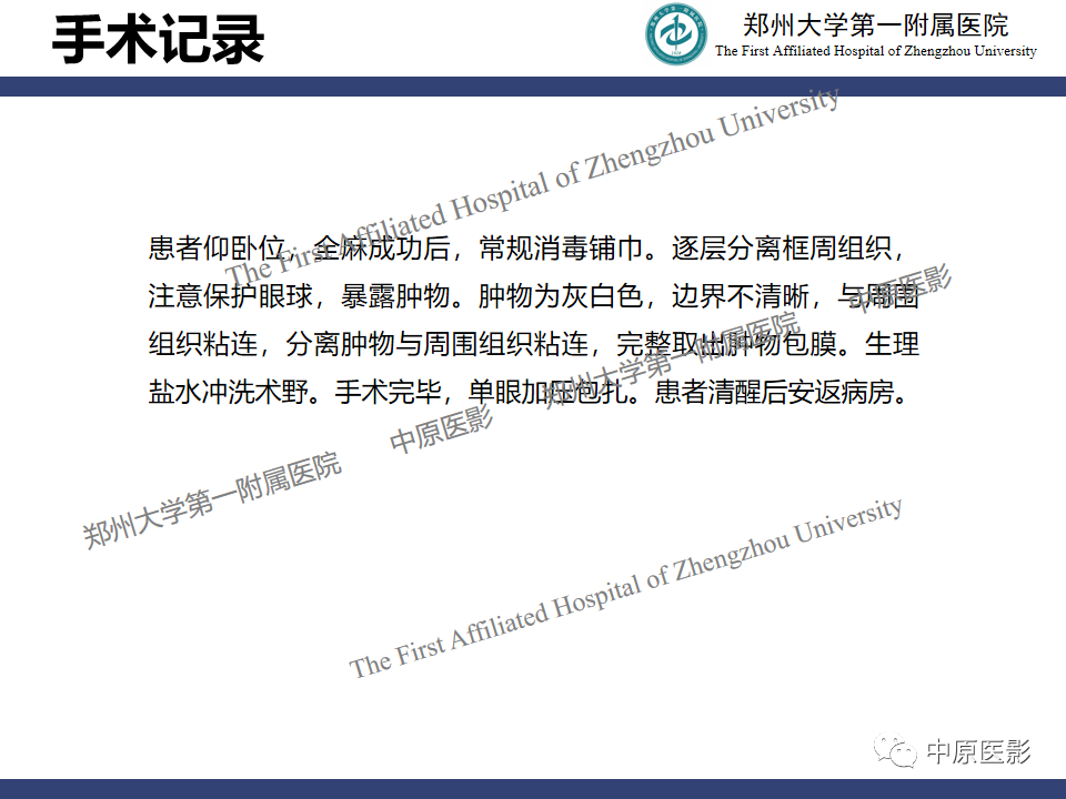 【病例】眼眶周围淋巴瘤1例CT及MR-9