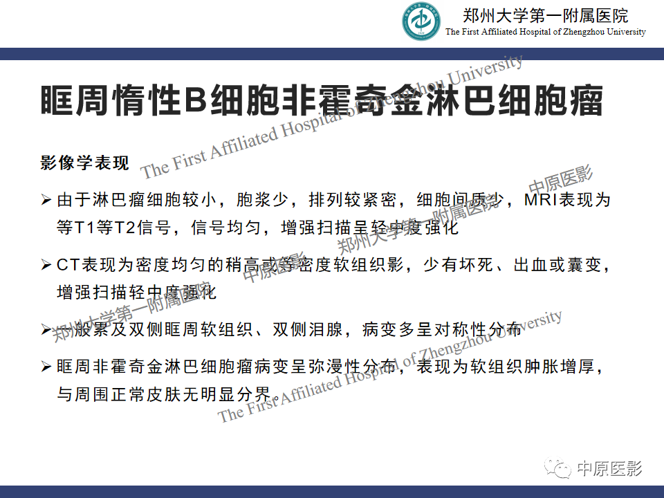 【病例】眼眶周围淋巴瘤1例CT及MR-13