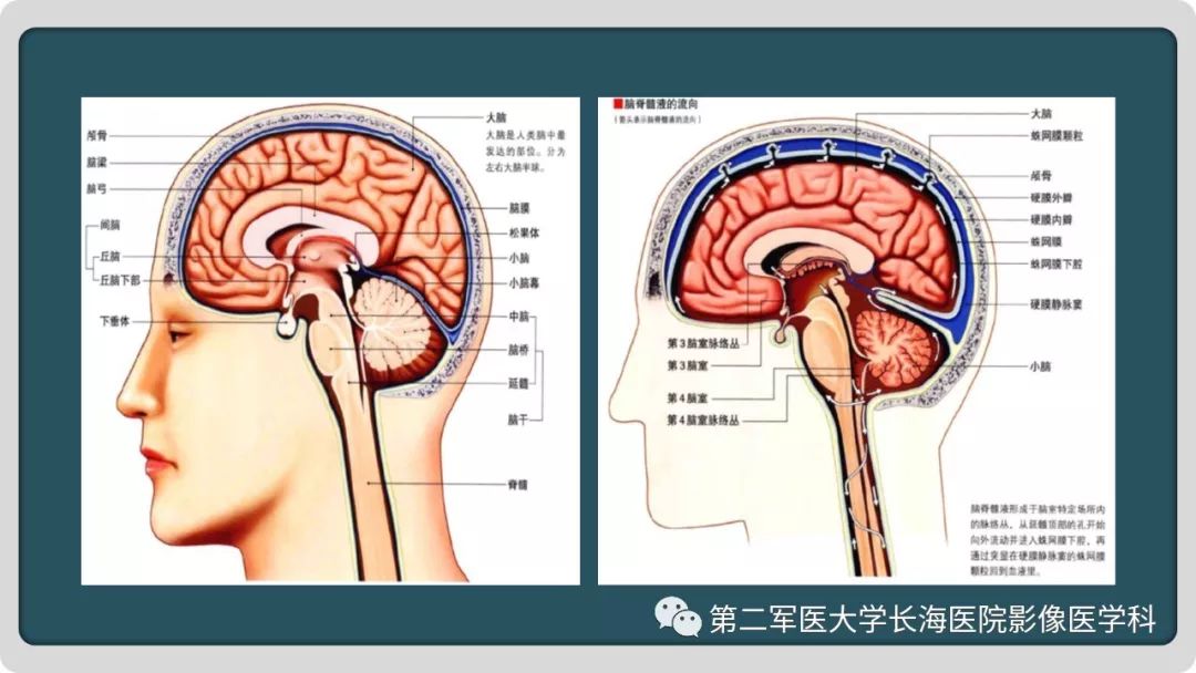 【PPT】颅内囊性病变影像表现-9