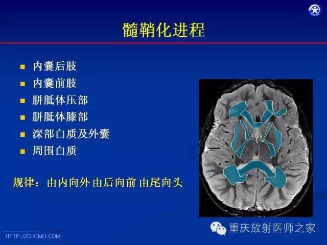 【PPT】脑白质髓鞘化及相关疾病的MRI表现-8