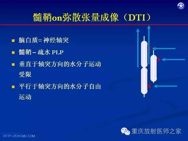 【PPT】脑白质髓鞘化及相关疾病的MRI表现-16