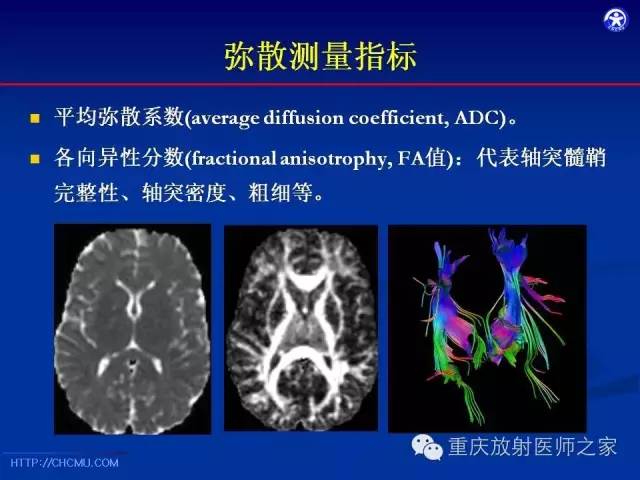 【PPT】脑白质髓鞘化及相关疾病的MRI表现-17