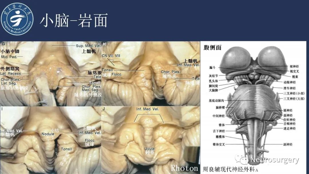 【PPT】小脑解剖-19