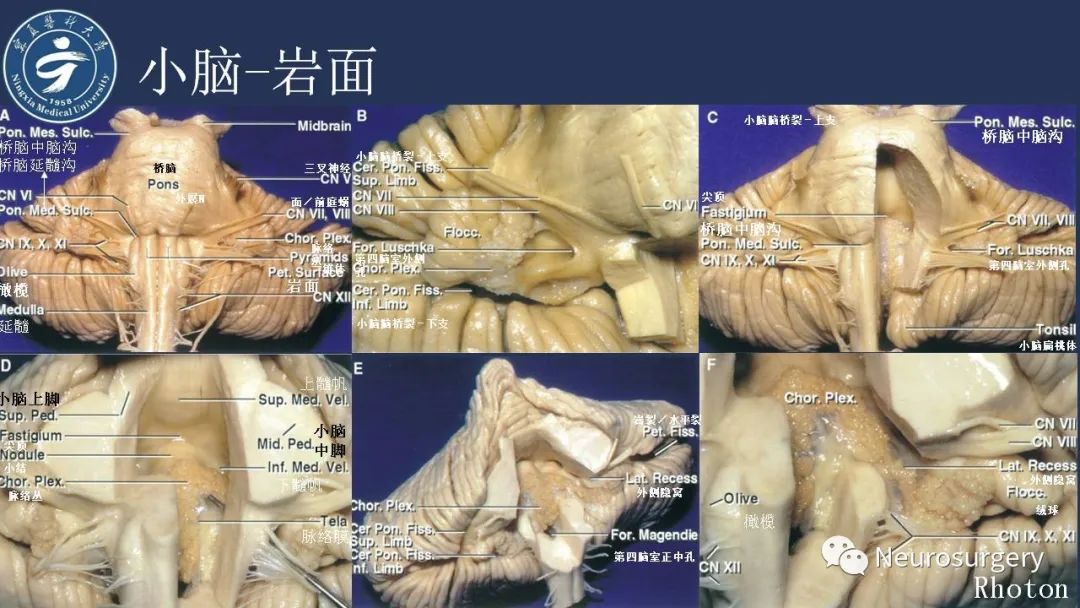 【PPT】小脑解剖-18