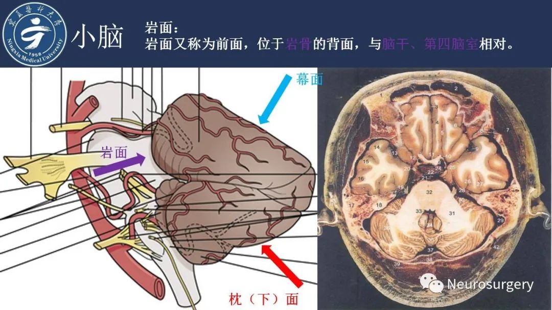 【PPT】小脑解剖-8
