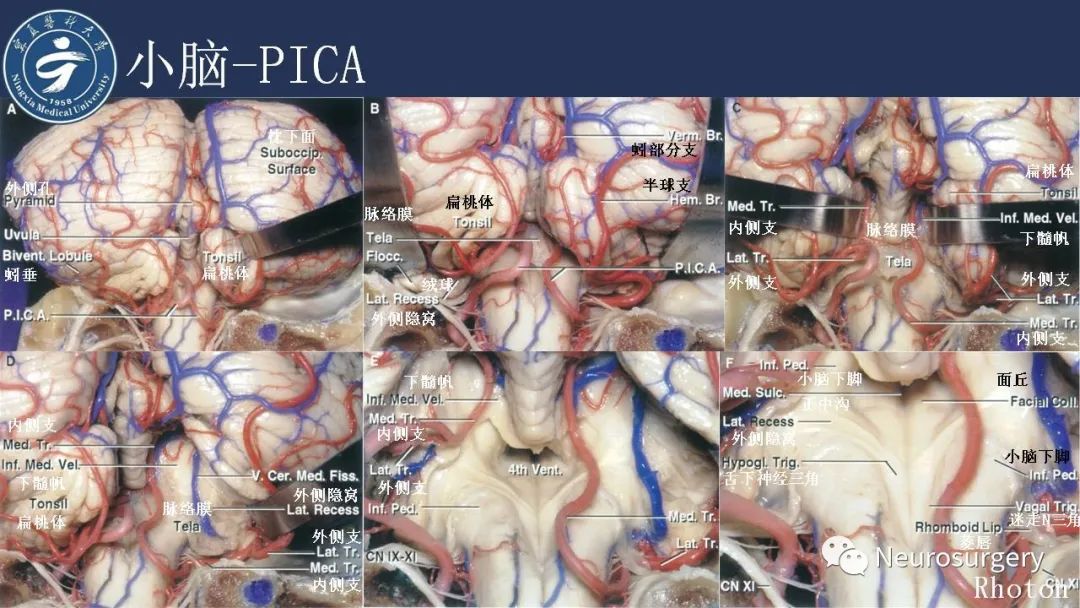 【PPT】小脑解剖-35