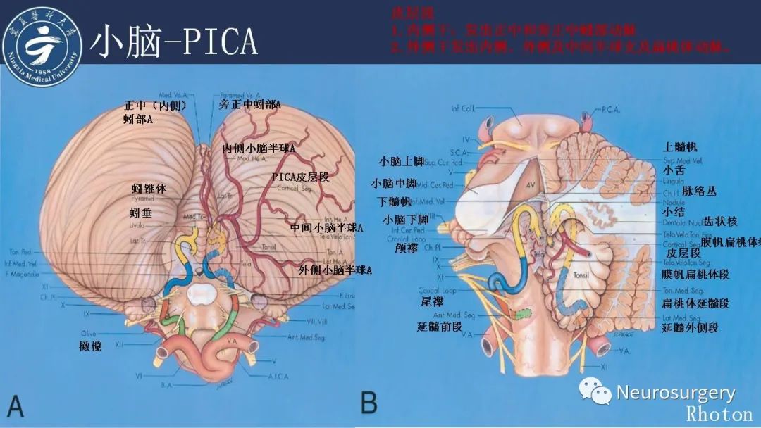 【PPT】小脑解剖-33