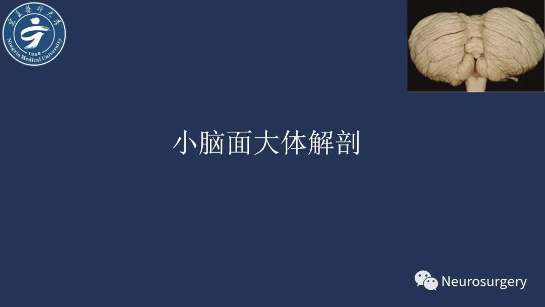 【PPT】小脑解剖-9