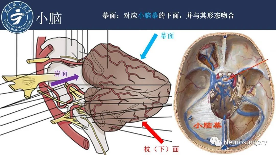 【PPT】小脑解剖-6