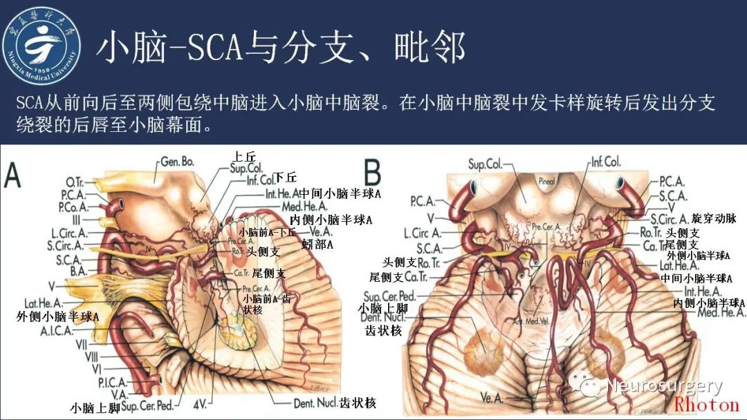 【PPT】小脑解剖-23