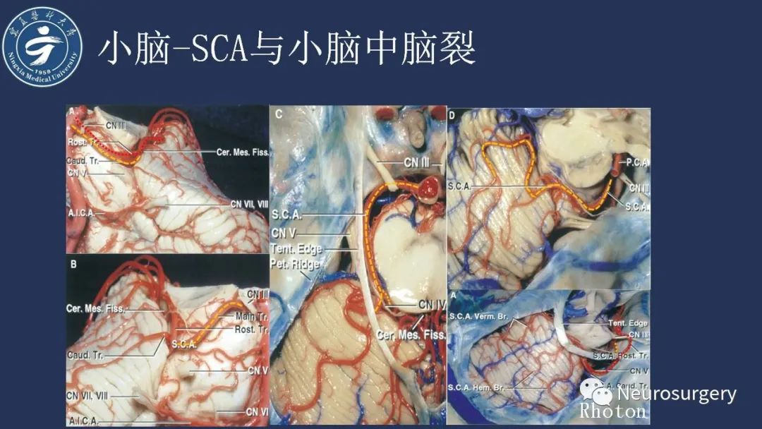 【PPT】小脑解剖-25