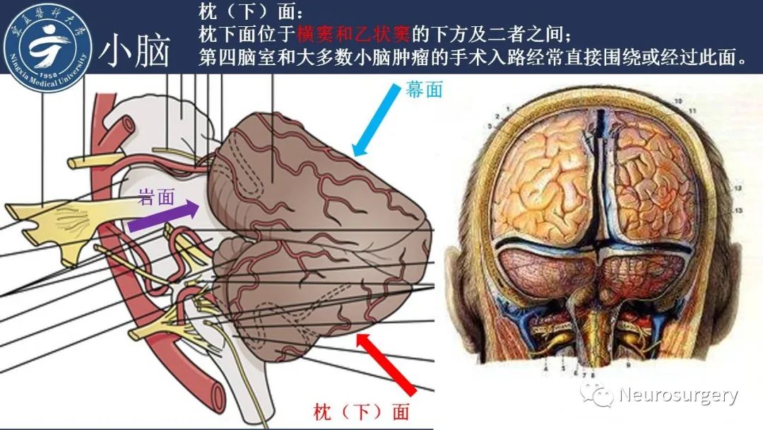 【PPT】小脑解剖-7