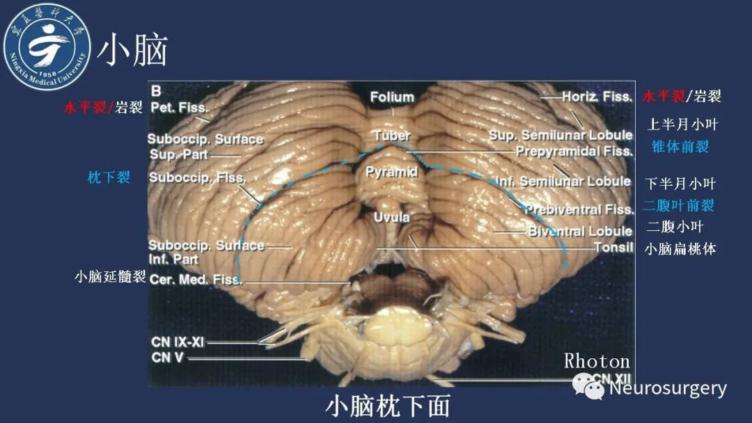 【PPT】小脑解剖-11