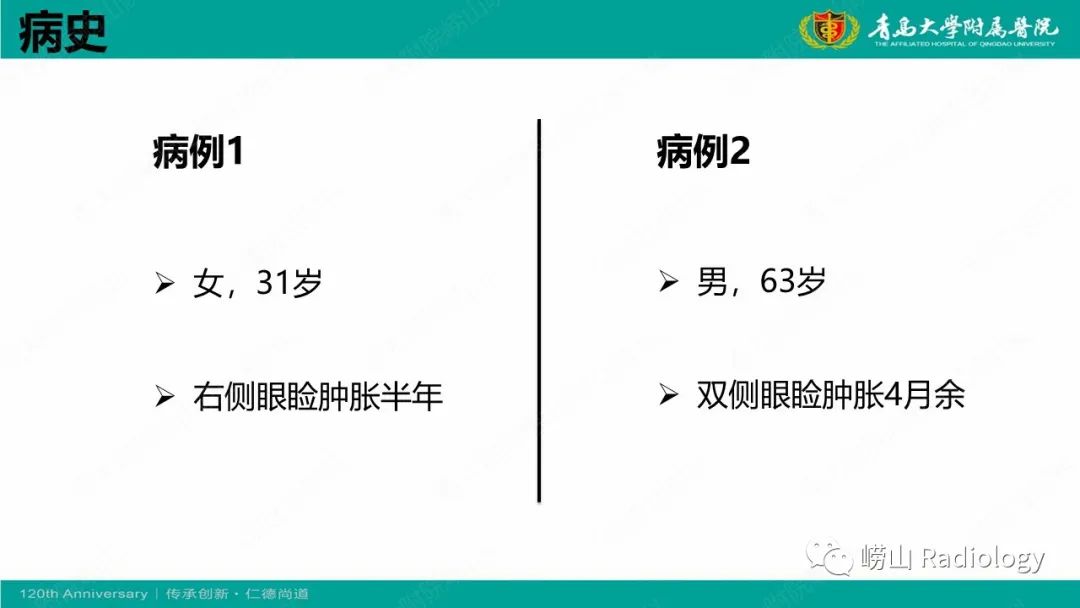 【病例】Rosai-Dorfman病 & 套细胞淋巴瘤-2