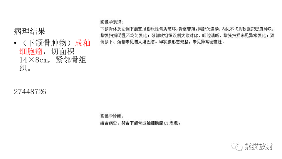 【病例】下颌骨成釉细胞瘤2例CT-18