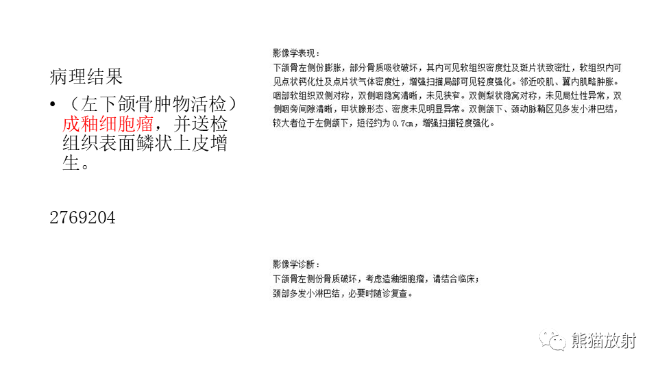 【病例】下颌骨成釉细胞瘤2例CT-19