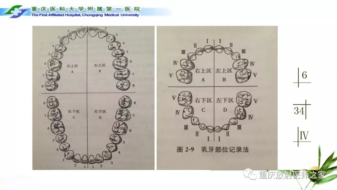 【PPT】颌骨常见肿瘤及肿瘤样病变的CT诊断及鉴别诊断-3