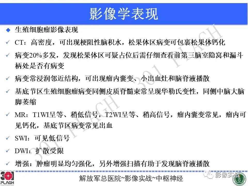【病例】中枢神经系统生殖细胞肿瘤1例MR-36