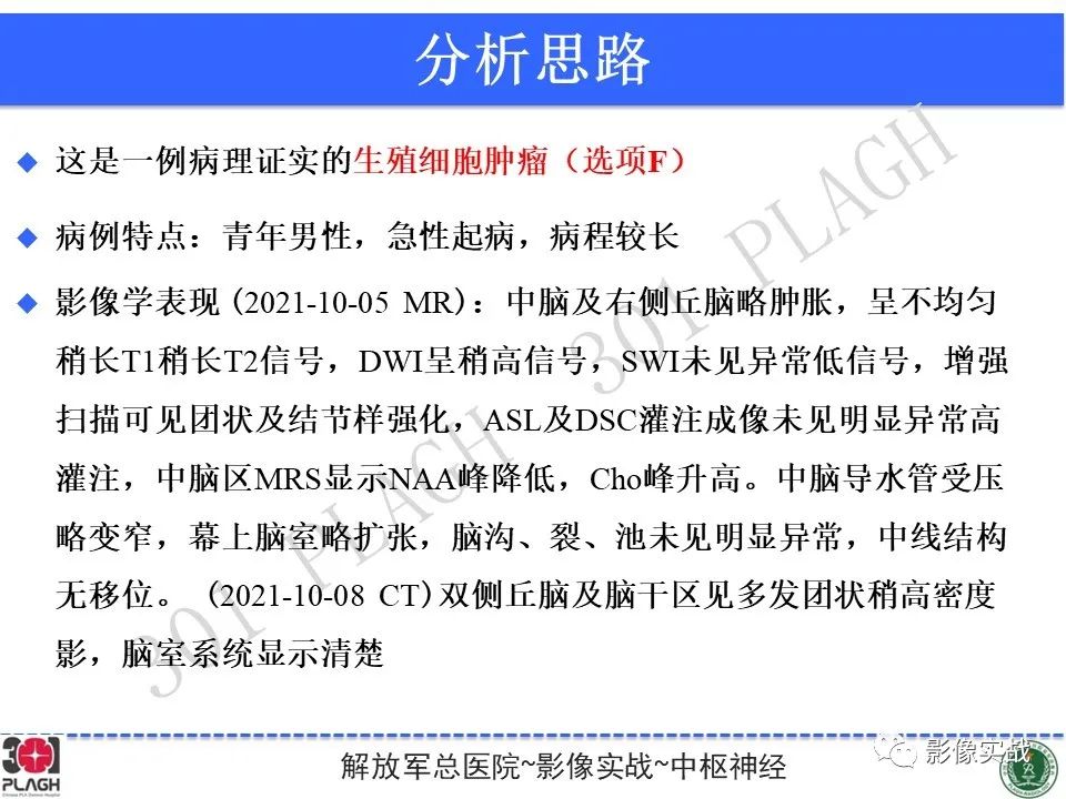 【病例】中枢神经系统生殖细胞肿瘤1例MR-28