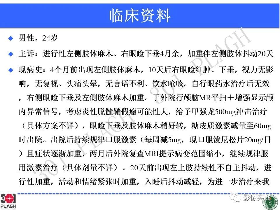 【病例】中枢神经系统生殖细胞肿瘤1例MR-2