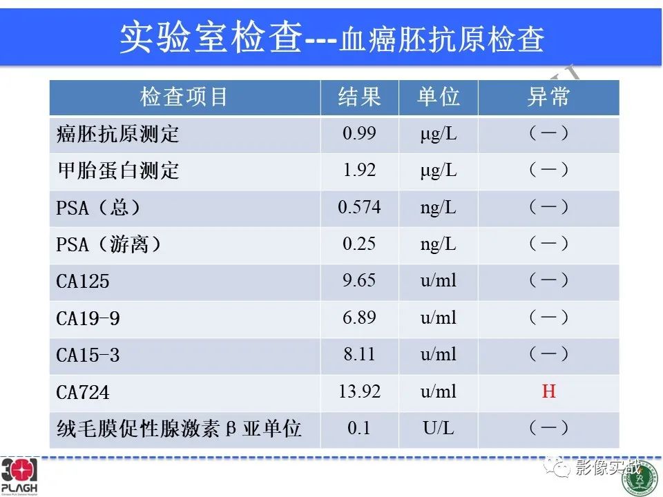 【病例】中枢神经系统生殖细胞肿瘤1例MR-5