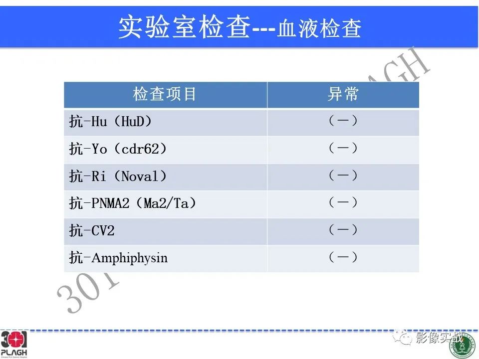 【病例】中枢神经系统生殖细胞肿瘤1例MR-6