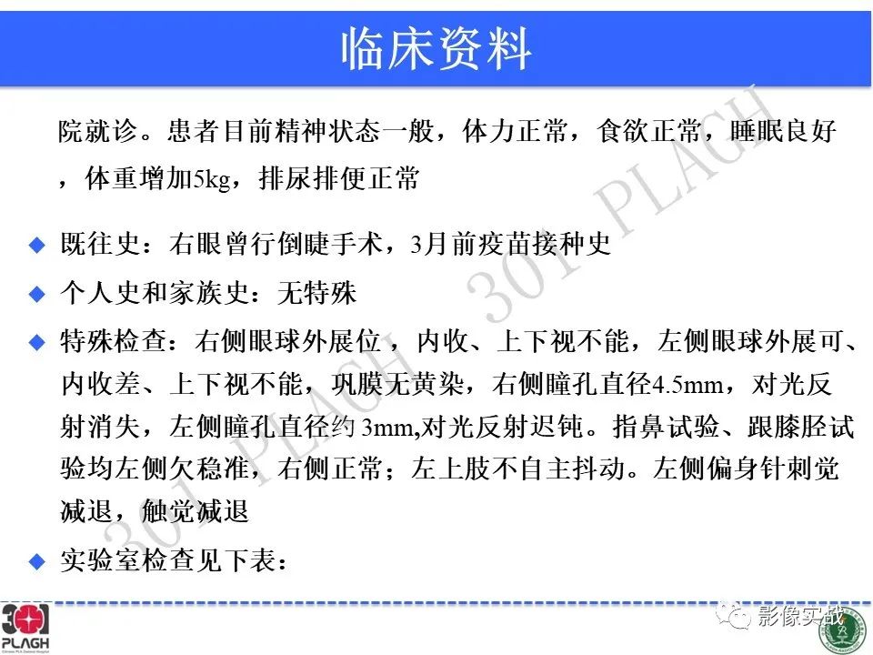 【病例】中枢神经系统生殖细胞肿瘤1例MR-3