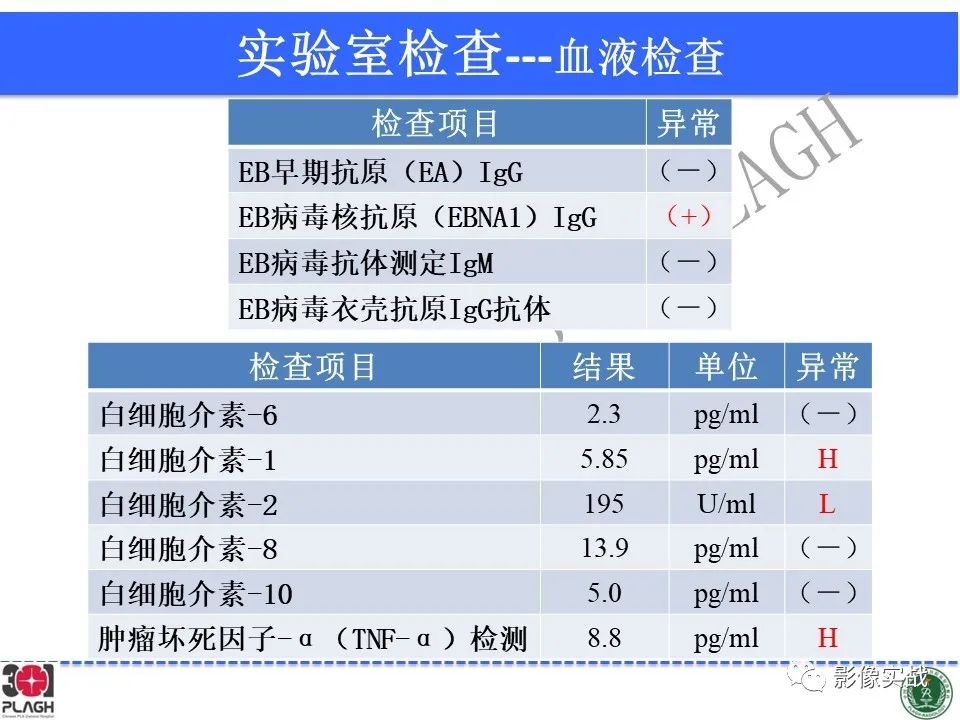 【病例】中枢神经系统生殖细胞肿瘤1例MR-7