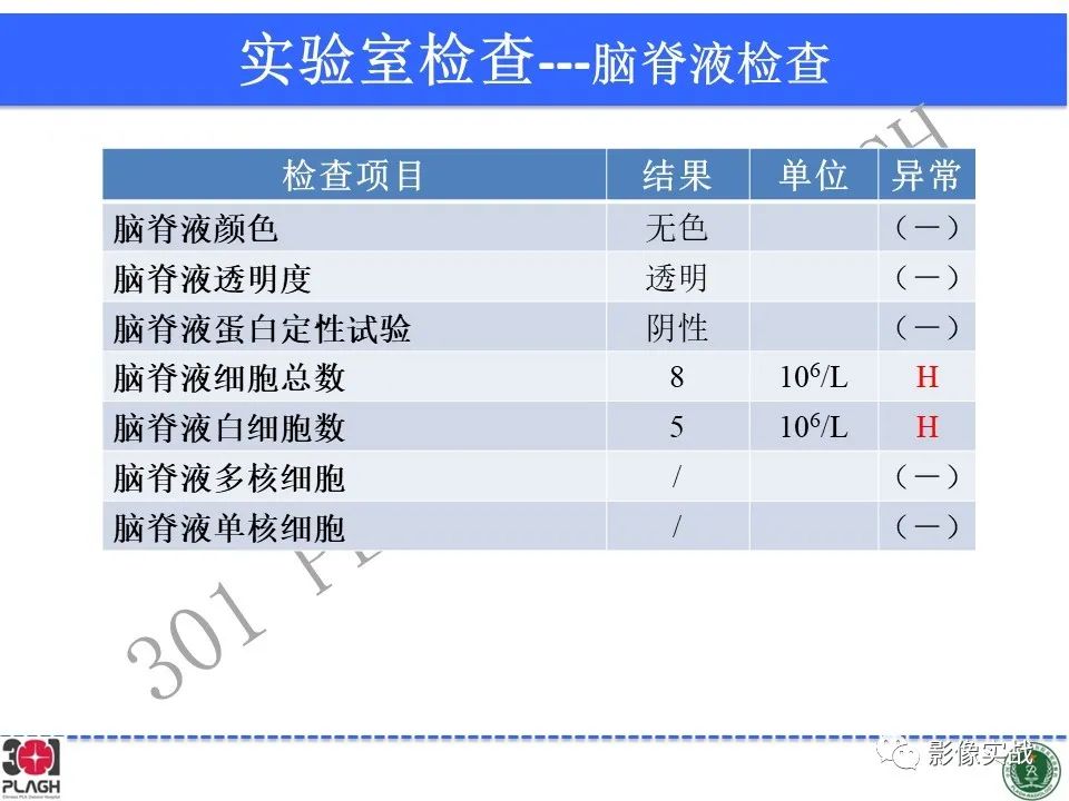 【病例】中枢神经系统生殖细胞肿瘤1例MR-9