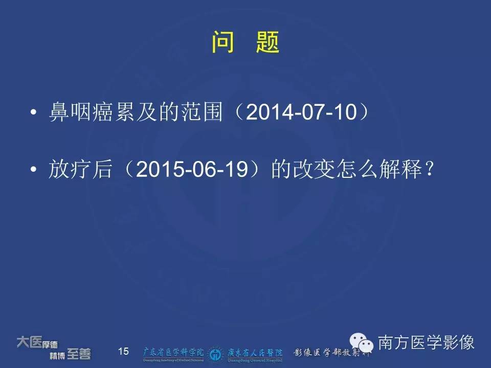 【PPT】鼻咽癌累及中耳及与中耳炎的鉴别-15