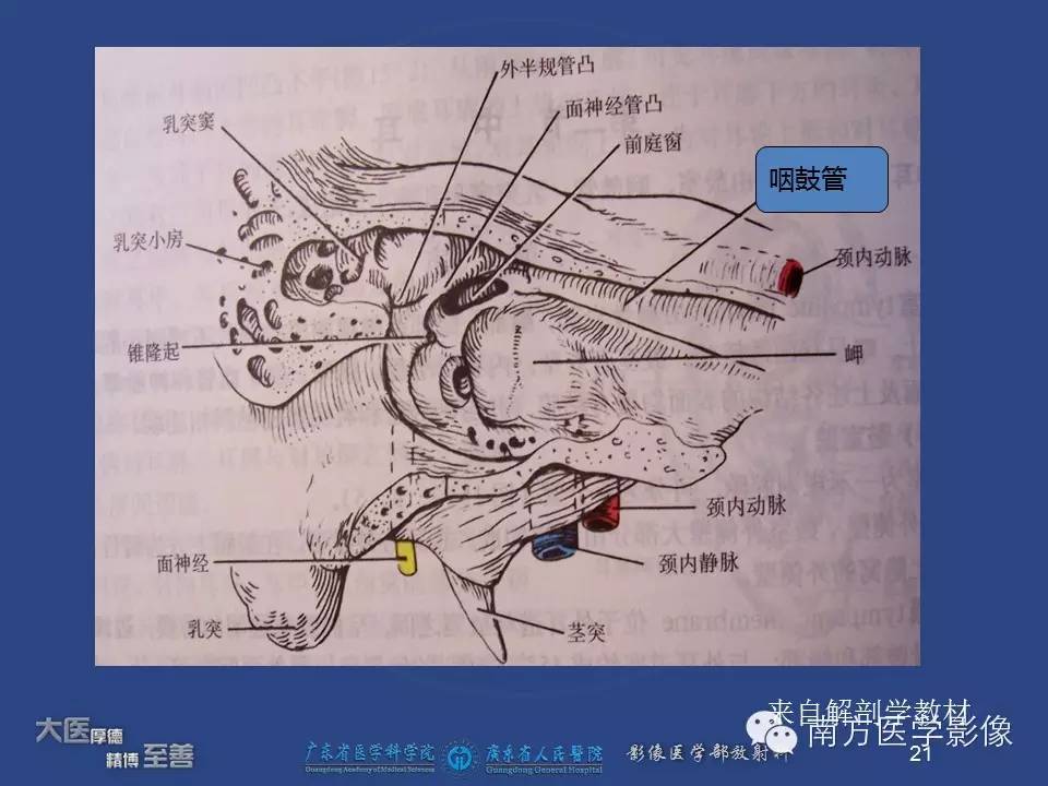 【PPT】鼻咽癌累及中耳及与中耳炎的鉴别-21