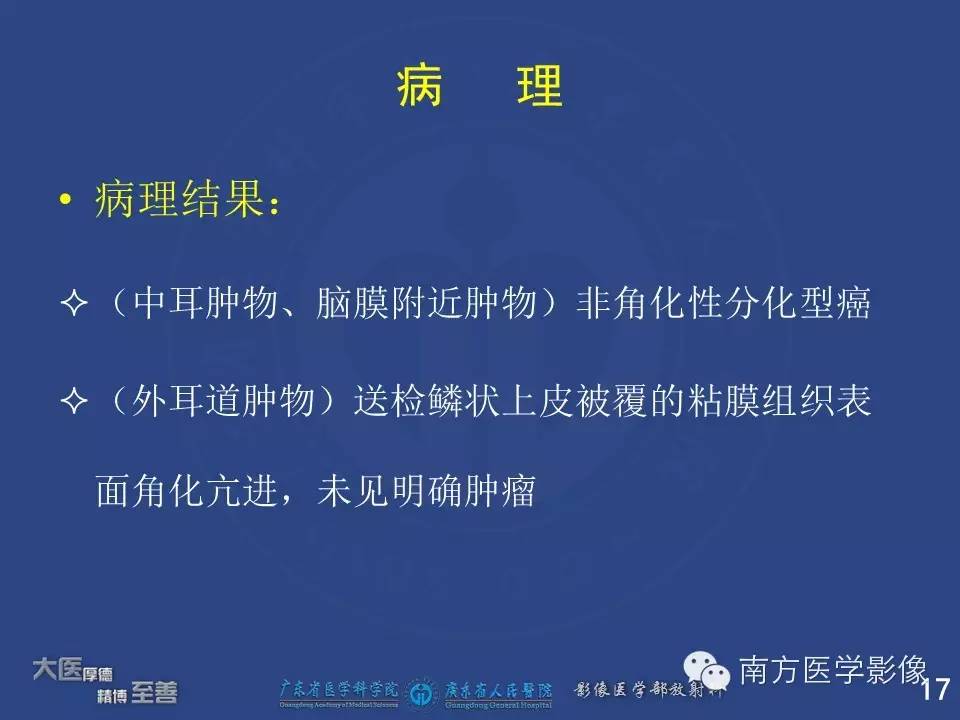 【PPT】鼻咽癌累及中耳及与中耳炎的鉴别-17