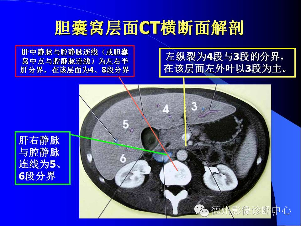 肝脏8段分法的影像学解剖