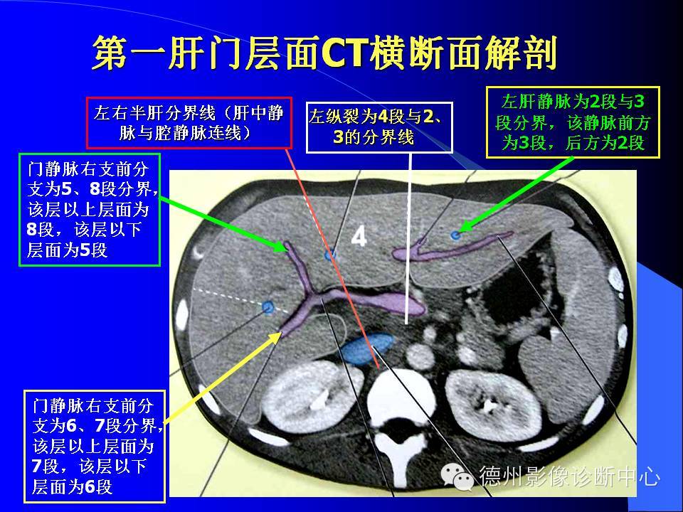 肝脏8段分法的影像学解剖