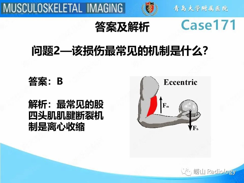 【PPT】股四头肌肌腱断裂-7