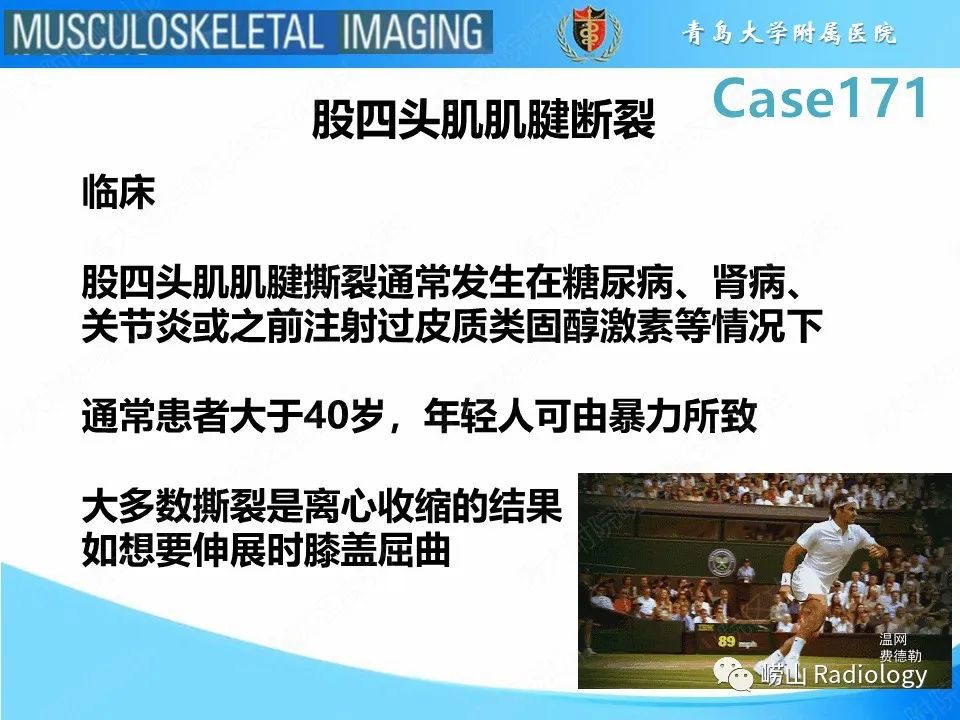 【PPT】股四头肌肌腱断裂-13