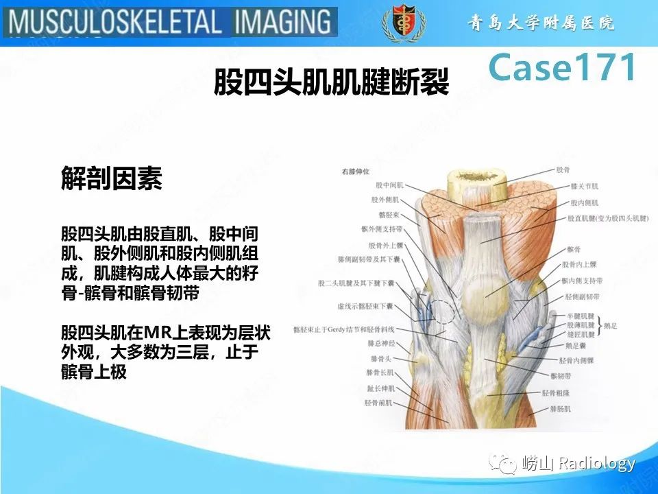 【PPT】股四头肌肌腱断裂-5