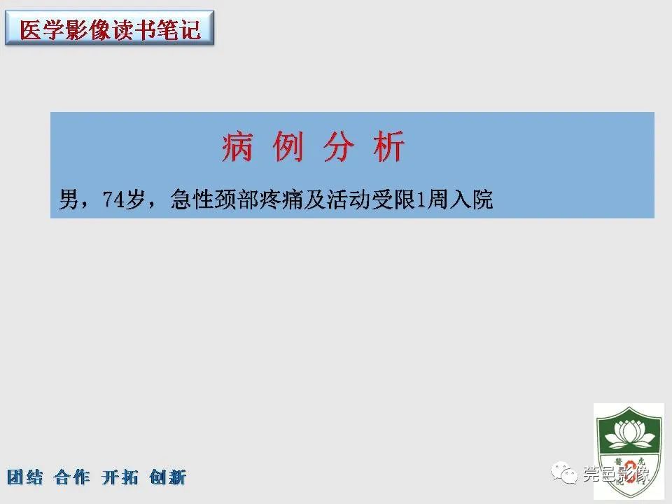 【PPT】齿状突加冠综合征-2