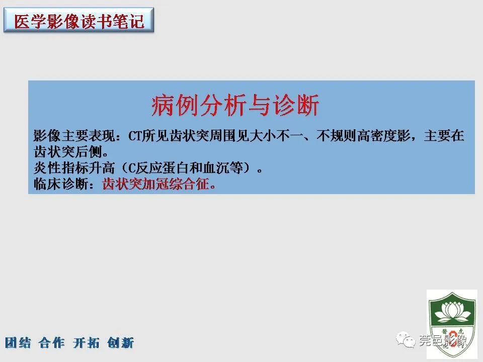 【PPT】齿状突加冠综合征-6