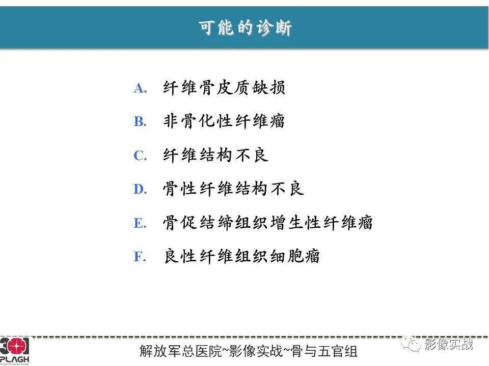 【病例】骨纤维结构不良1例X线MR影像-9
