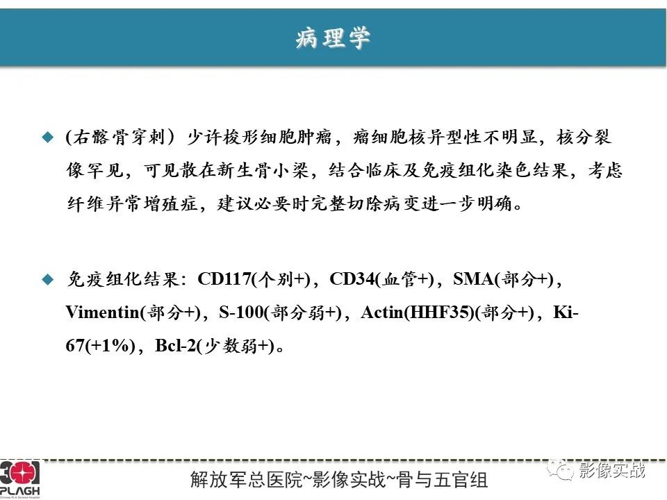 【病例】骨纤维结构不良1例X线MR影像-10
