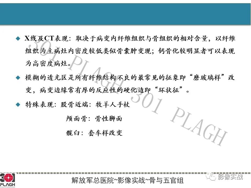 【病例】骨纤维结构不良1例X线MR影像-12