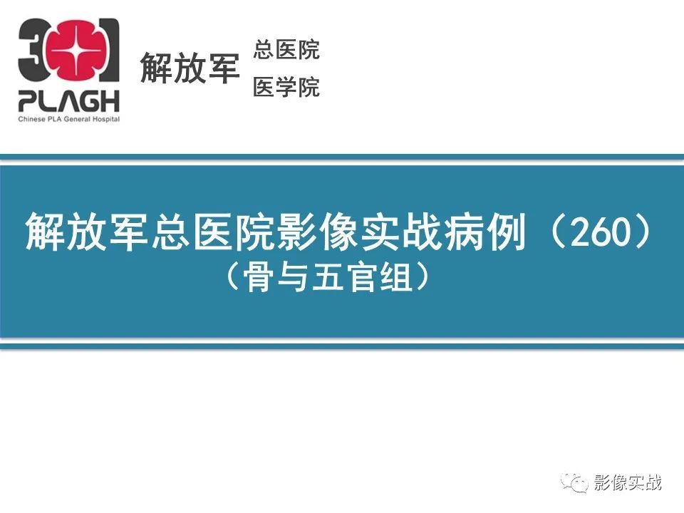 骨纤维结构不良1例X线MR影像