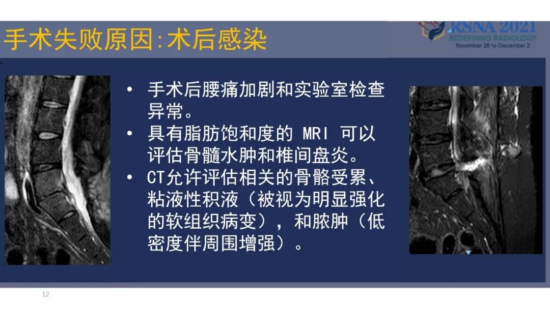 【PPT】术后脊柱-为了外科医生和患者安全着想的金属图像-35