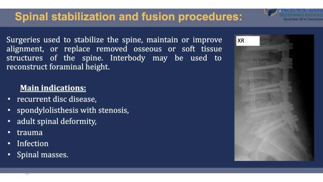【PPT】术后脊柱-为了外科医生和患者安全着想的金属图像-14