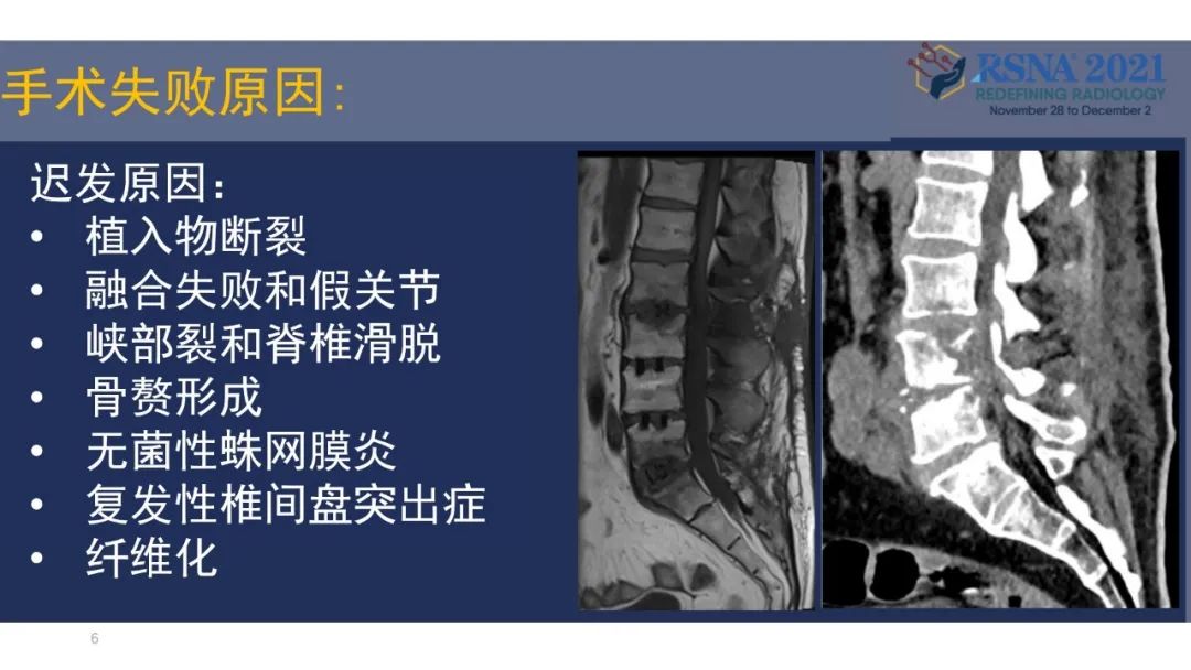 【PPT】术后脊柱-为了外科医生和患者安全着想的金属图像-29